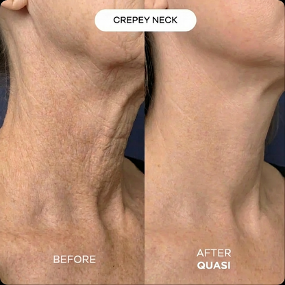 Collagen Neck Mask